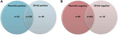 PD-L1 Testing in Urothelial Carcinoma: Analysis of a Series of 1401 Cases Using Both the 22C3 and SP142 Assays